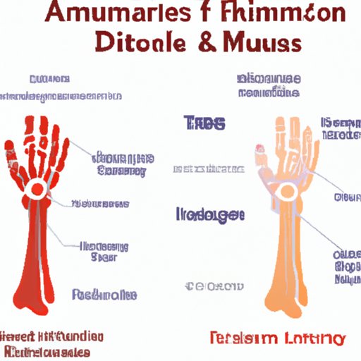 Understanding the Link between Rheumatic Disease and Autoimmune Disorders